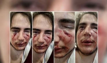 Imputan a dos rugbiers por la golpiza a un adolescente en Córdoba