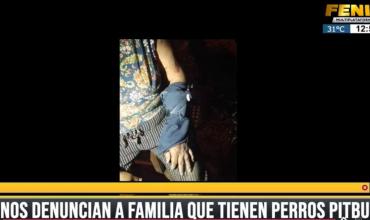 Barrio Virgen del Cerro I: Una mujer fue atacada por varios perros pitbull