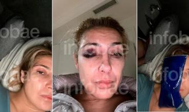 Se conocieron nuevas fotos de Fabiola Yañez con golpes en su cara